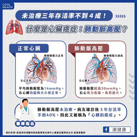 肺動脈 高壓 看 哪 科